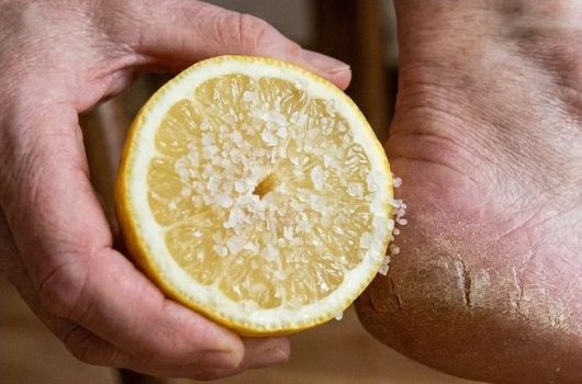 receita caseira para dor no calcanhar