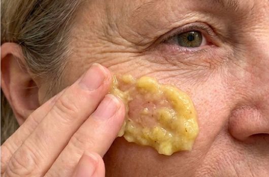 receita caseira para rugas